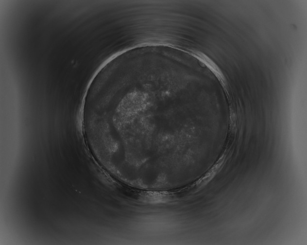 X0000100311052200806190938
