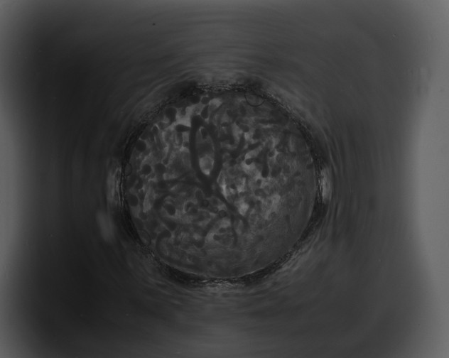 X0000100311059200806190938