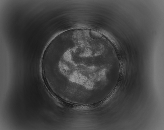 X0000100311094200806190937