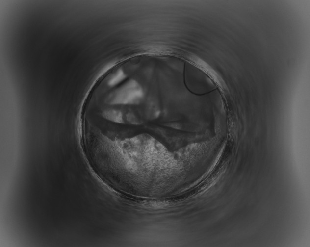 X0000100311095200806190937