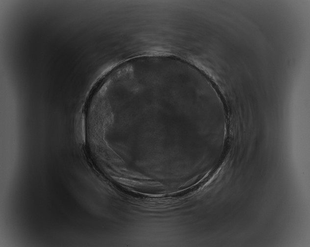 X0000100311171200806190936
