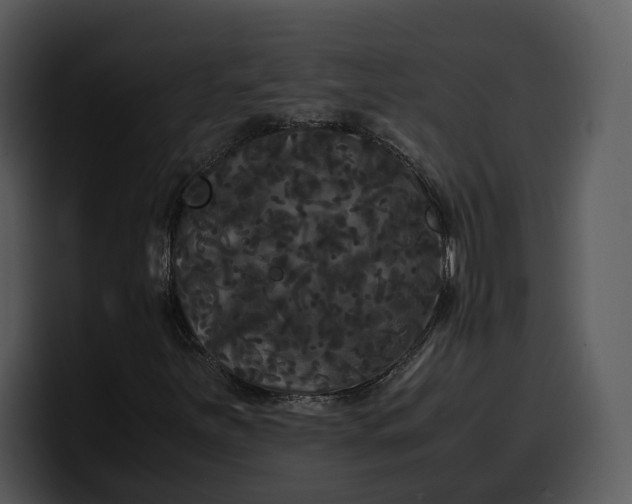 X0000100311251200806190935