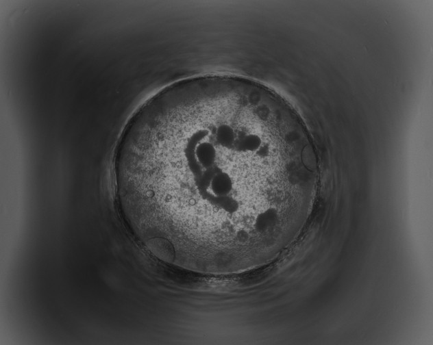X0000100311271200806190935