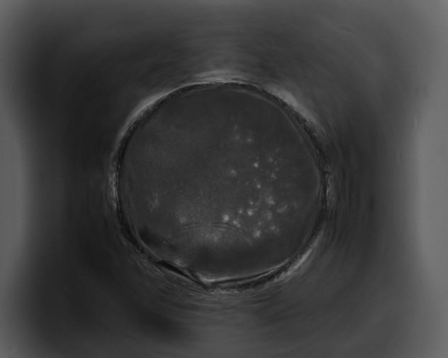 X0000100311358200806190934