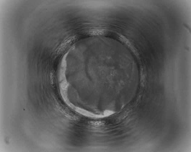 X0000100310161200806261210