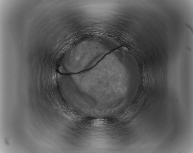 X0000100310320200806261208