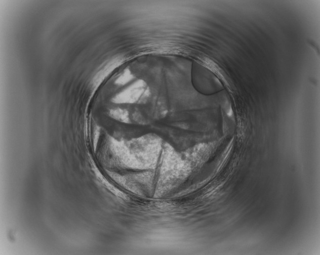 X0000100311095200806261156