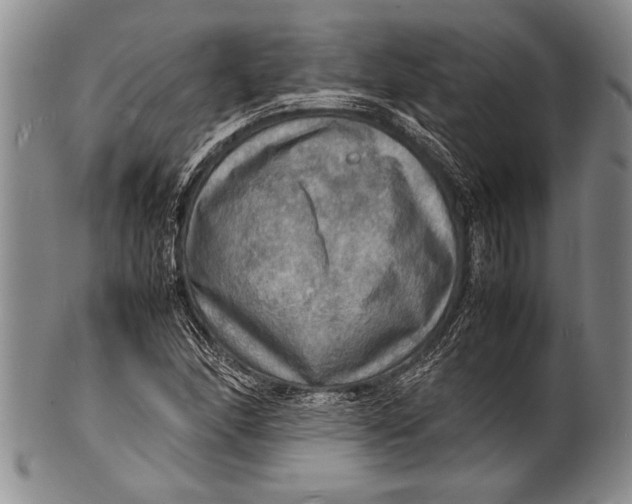 X0000100311166200806261155