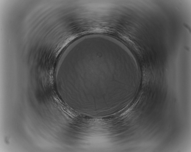 X0000100311170200806261155