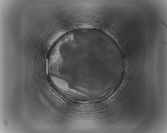 X0000100311171200806261155