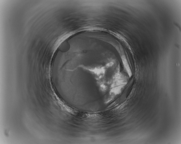 X0000100311231200806261155