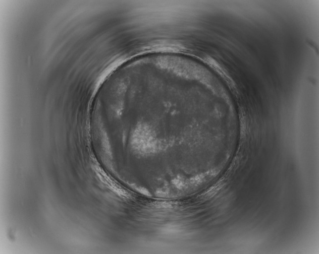 X0000100311240200806261155