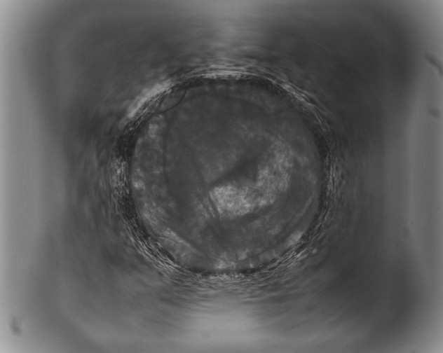 X0000100311351200806261152