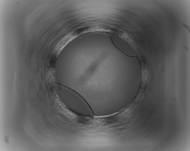 X0000100311369200806261152