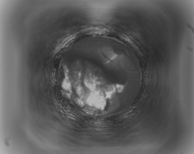 X0000100311399200806261151