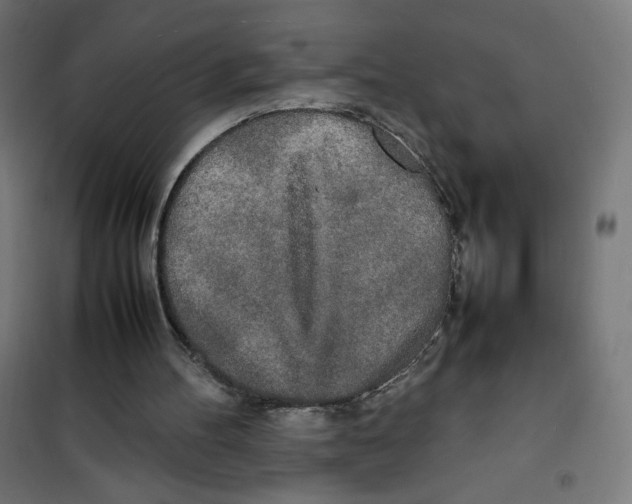 X0000100310100200807031156