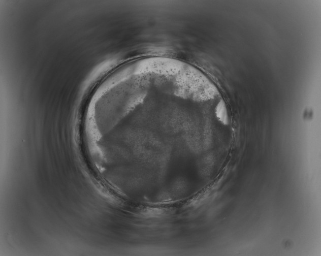 X0000100310149200807031155