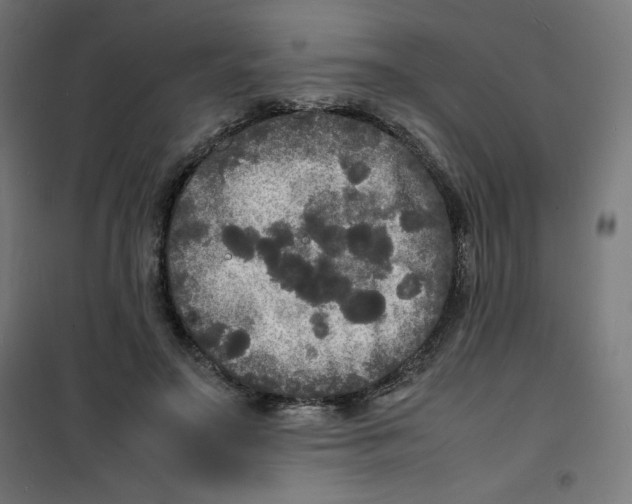X0000100310499200807031150