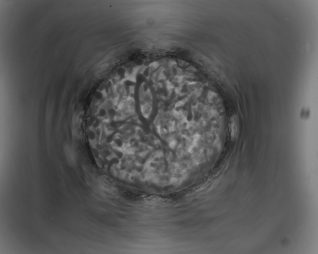 X0000100311059200807031141