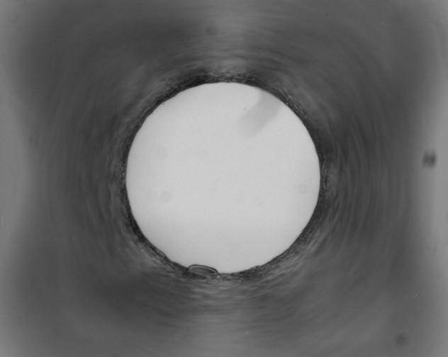 X0000100311153200807031140