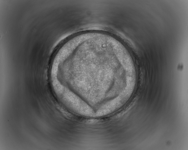 X0000100311166200807031140