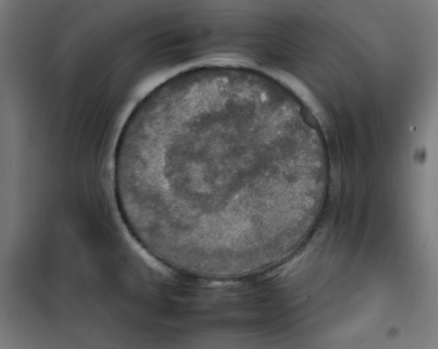 X0000100311335200807031138