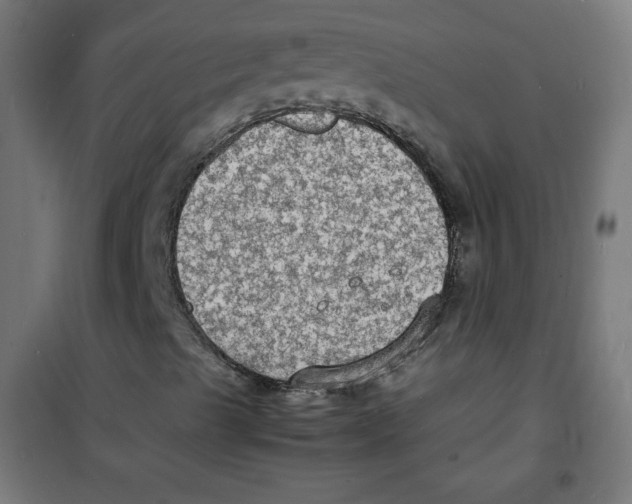 X0000100311489200807031134