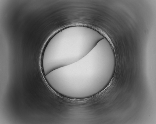 X0000100331197200806051157