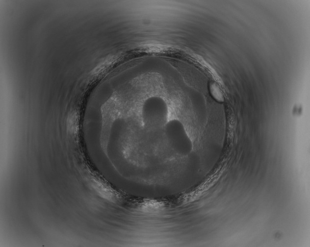 X0000100330257200806051541