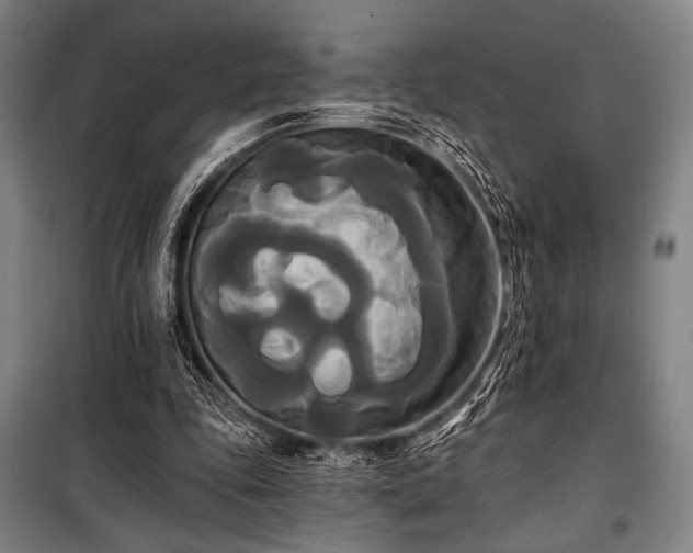 X0000100330343200806051539