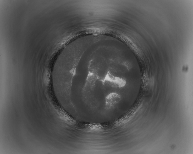 X0000100330355200806051539