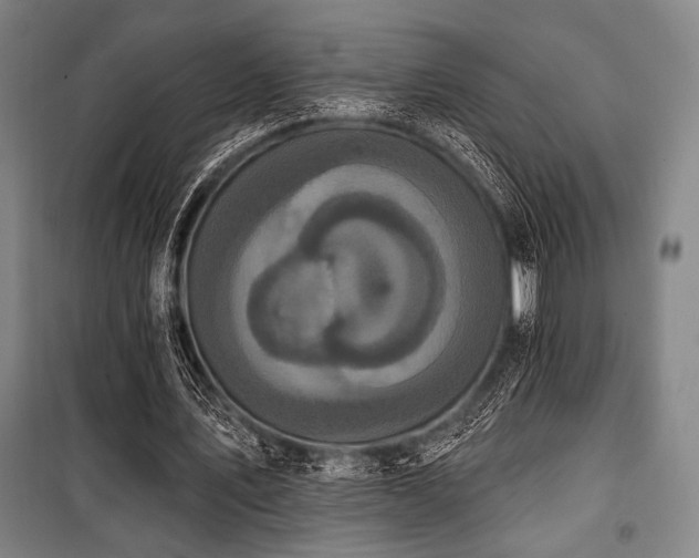 X0000100330579200806051536