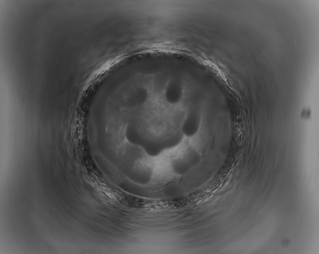 X0000100331159200806051527