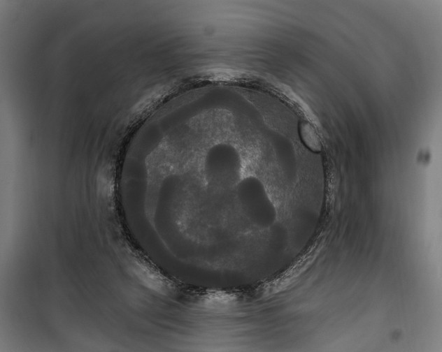 X0000100330257200806121134