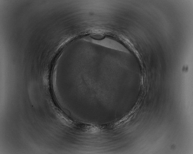 X0000100330249200806191115