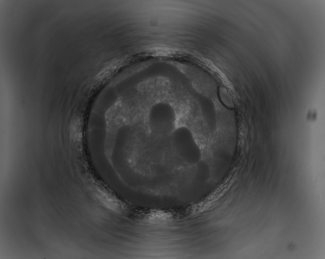 X0000100330257200806191115