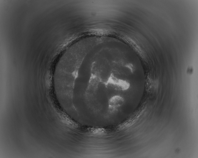 X0000100330355200806191113