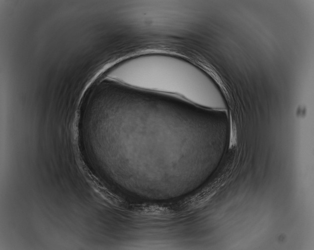 X0000100330387200806191113