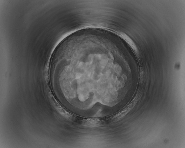 X0000100331052200806191103