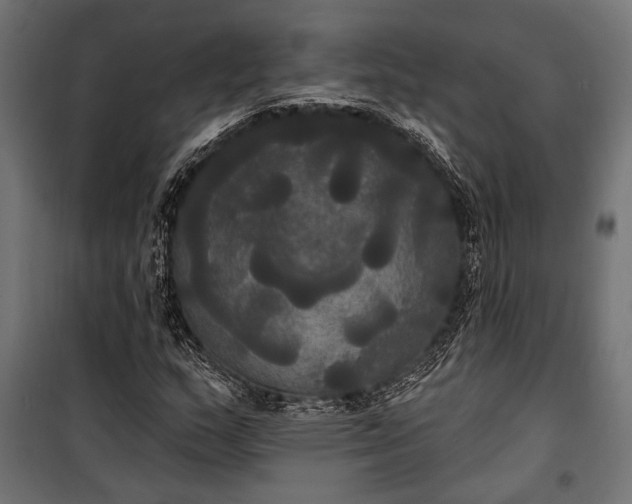 X0000100331159200806191101