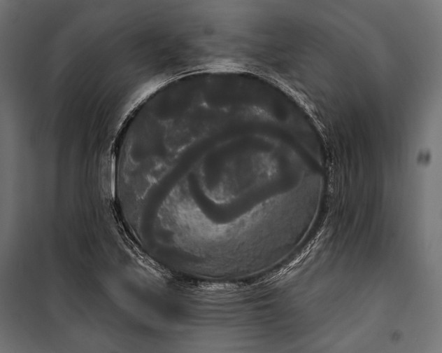 X0000100331171200806191101