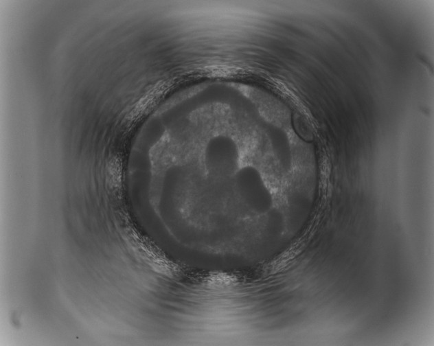 X0000100330257200806261309