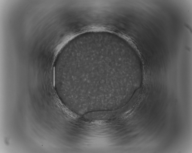 X0000100331175200806261254