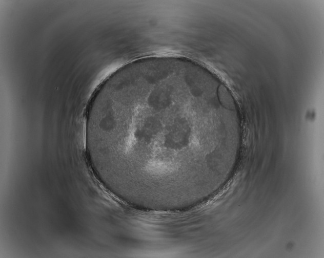 X0000100341171200806121144