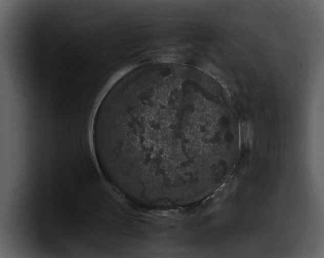 X0000100340147200806191031