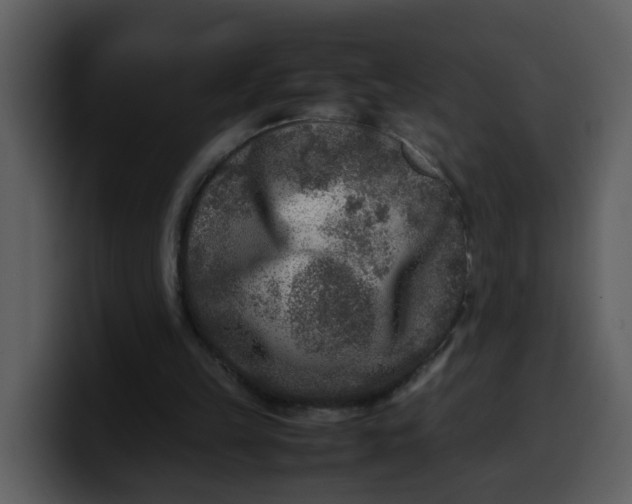 X0000100340149200806191031