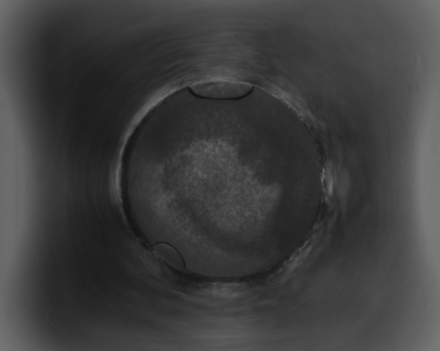 X0000100340292200806191030