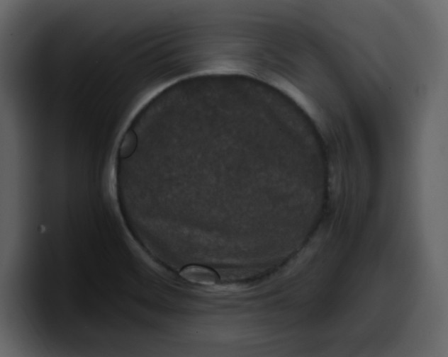 X0000100341468200806191014