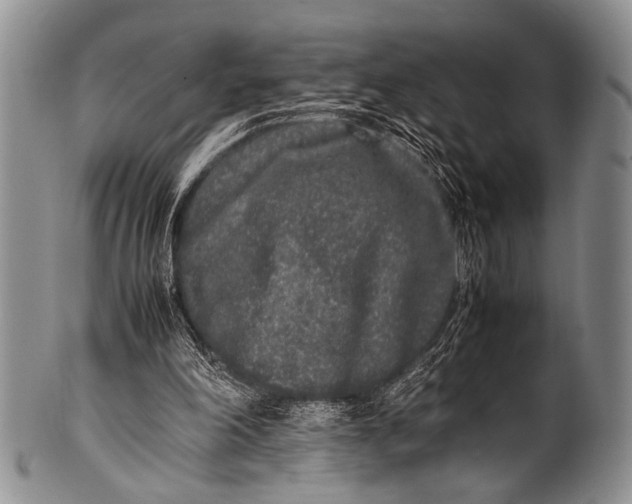 X0000100340198200806261335