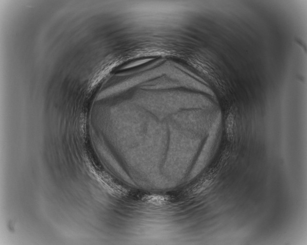 X0000100340352200806261332